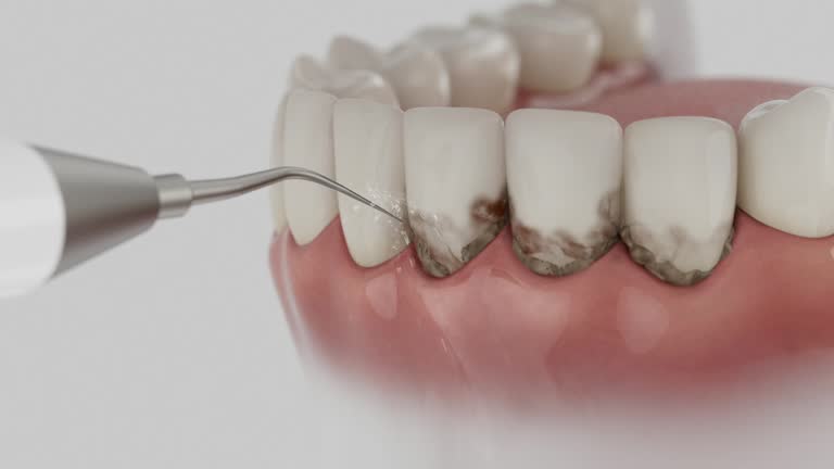 Reliable Dental Implants contractor in Fullerton, NE by Smile Center Dentistry